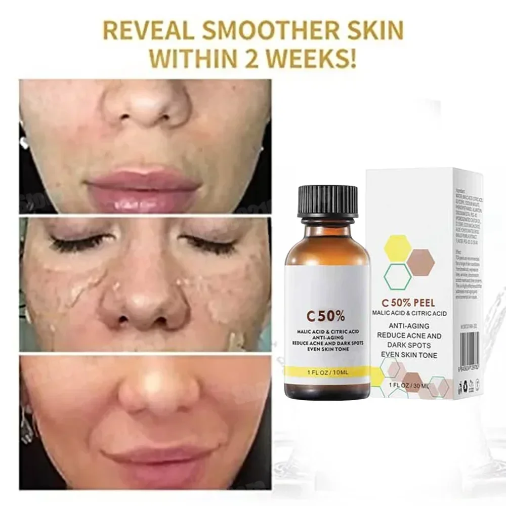 Skincare Salicylic Acid - Salicylic Acid Face Facial Peel Neutraliser
