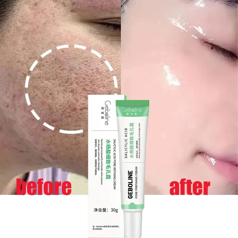 Skincare Salicylic Acid - Salicylic Acid Pore Shrinking Cream Quick