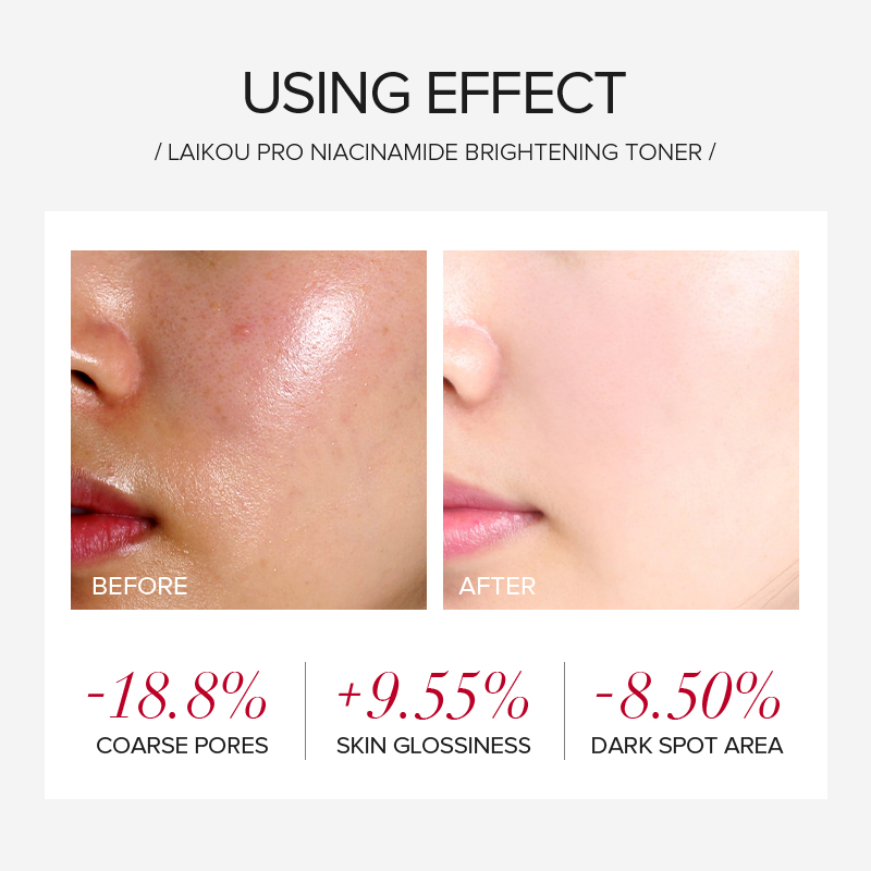 LAIKOU PRO Niacinamide 4Pcs Br - Niacinamide Brightening Serum 评论和价格