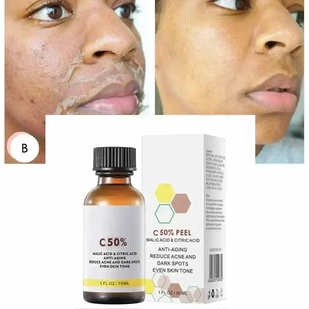 Salicylic Acid Face Facial Pee - Skincare Salicylic Acid 评论和价格