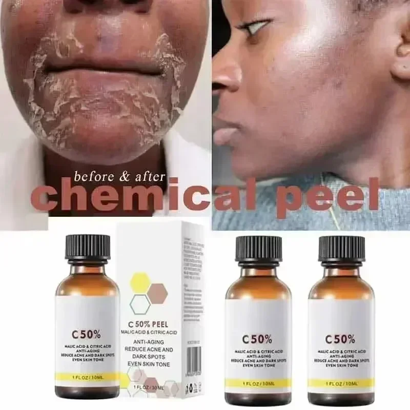 Salicylic Acid Face Facial Pee - Skincare Salicylic Acid 评论和价格
