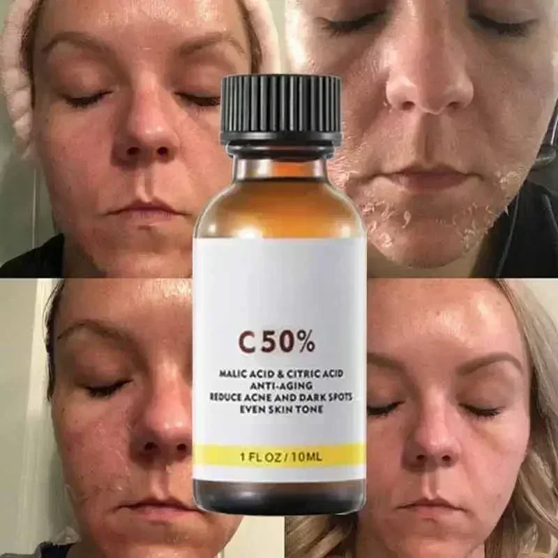 Salicylic Acid Face Facial Pee - Skincare Salicylic Acid 评论和价格