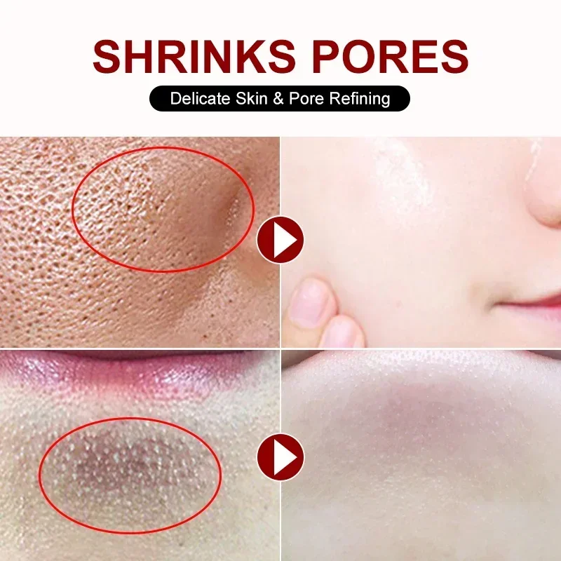 Salicylic Acid Pore Shrinking  - Skincare Salicylic Acid 评论和价格