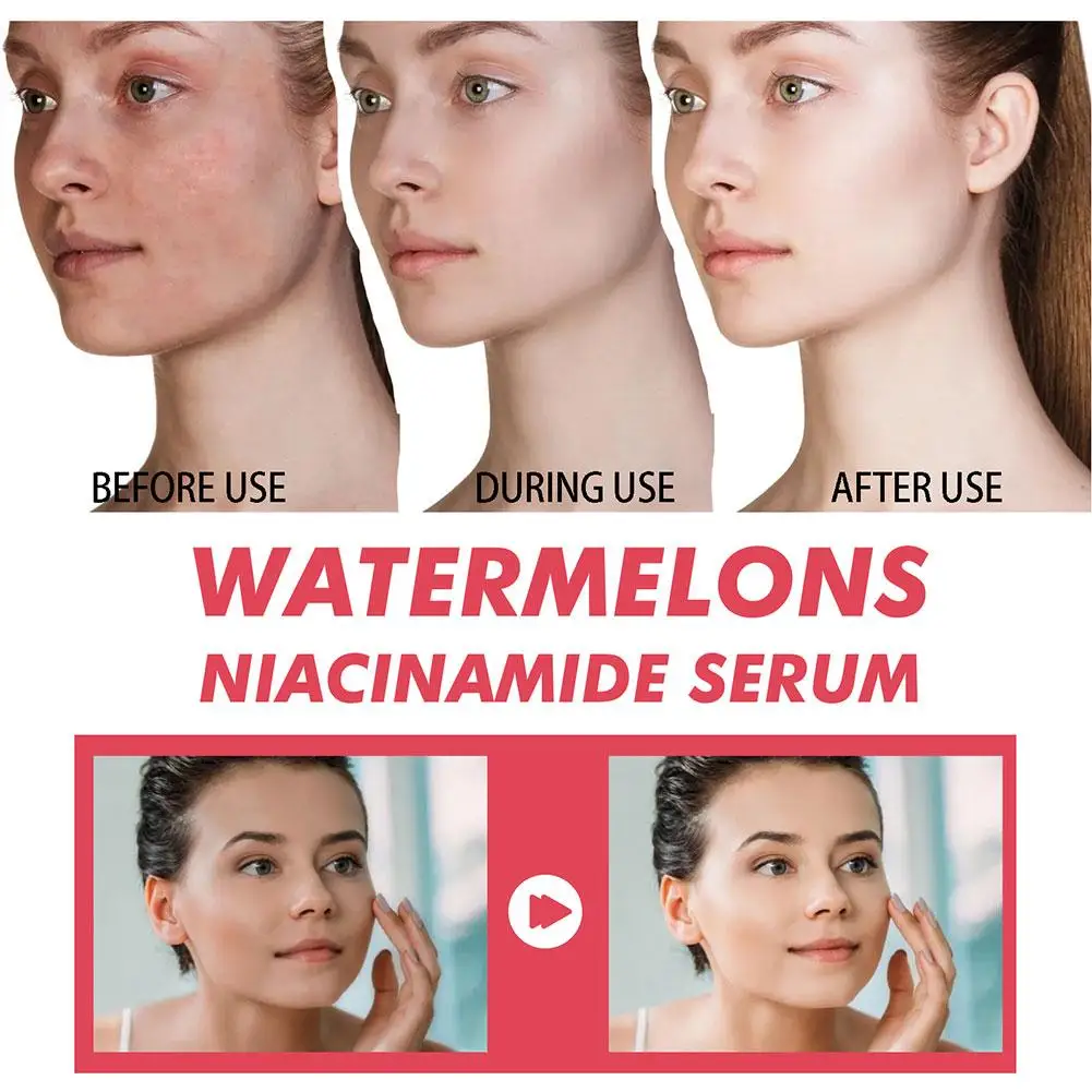 Watermelon Glow Niacinamide Mo - Niacinamide Brightening Serum 评论和价格