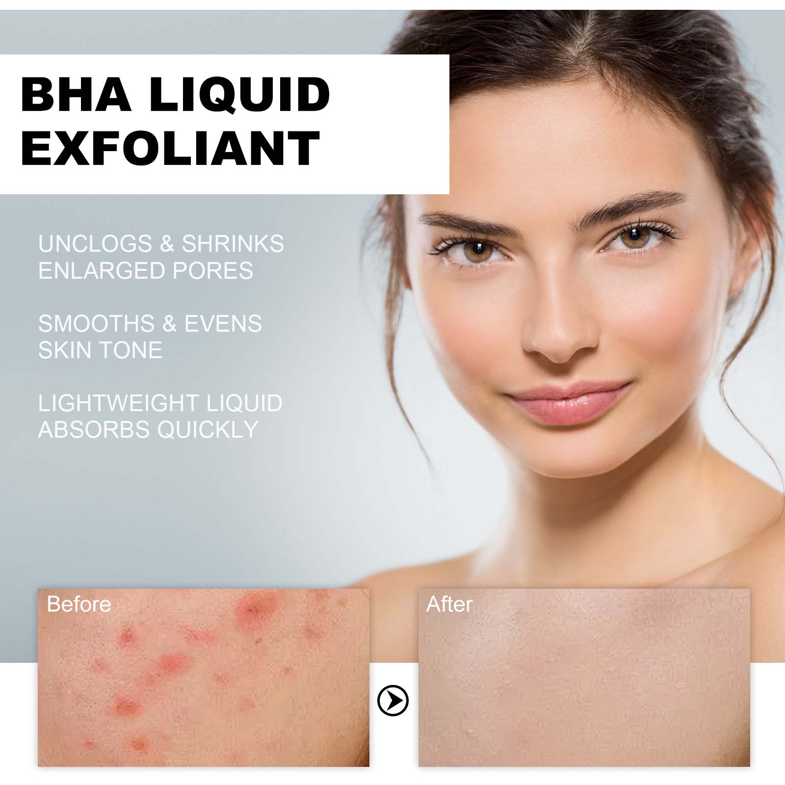 2% Salicylic Acid Liquid Exfol - Skincare Salicylic Acid 评论和价格