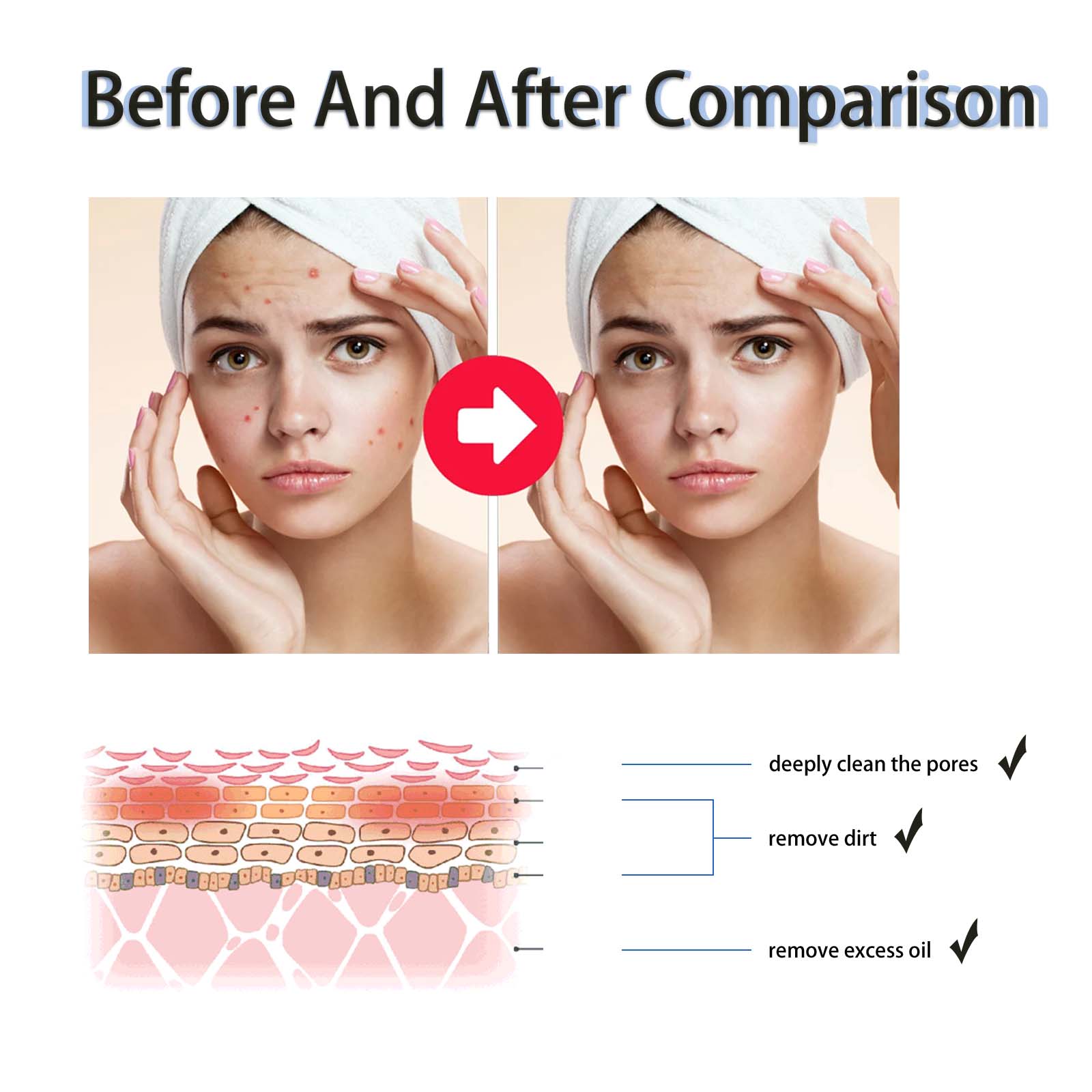 2% Salicylic Acid Liquid Exfol - Skincare Salicylic Acid 评论和价格