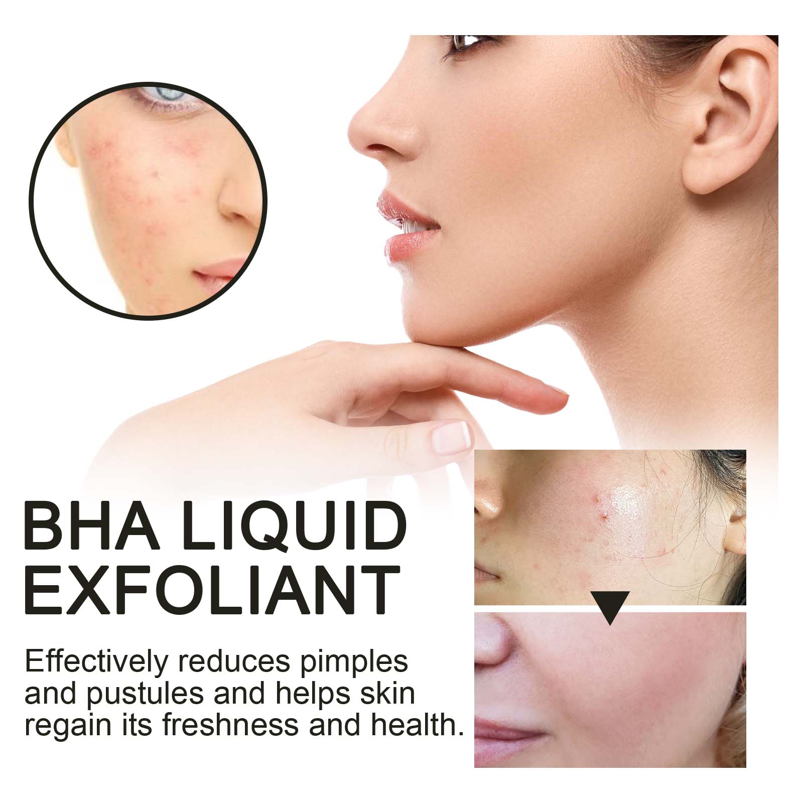 2% Salicylic Acid Liquid Exfol - Skincare Salicylic Acid 评论和价格