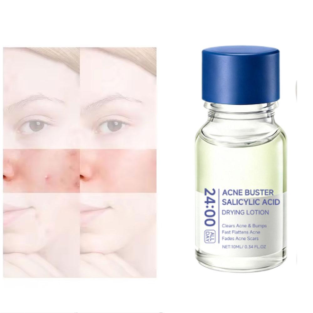 Salicylic Acid Essence Treatme - Skincare Salicylic Acid 评论和价格