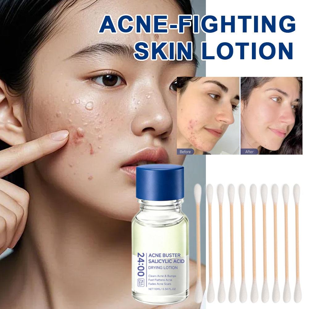 Salicylic Acid Essence Treatme - Skincare Salicylic Acid 评论和价格