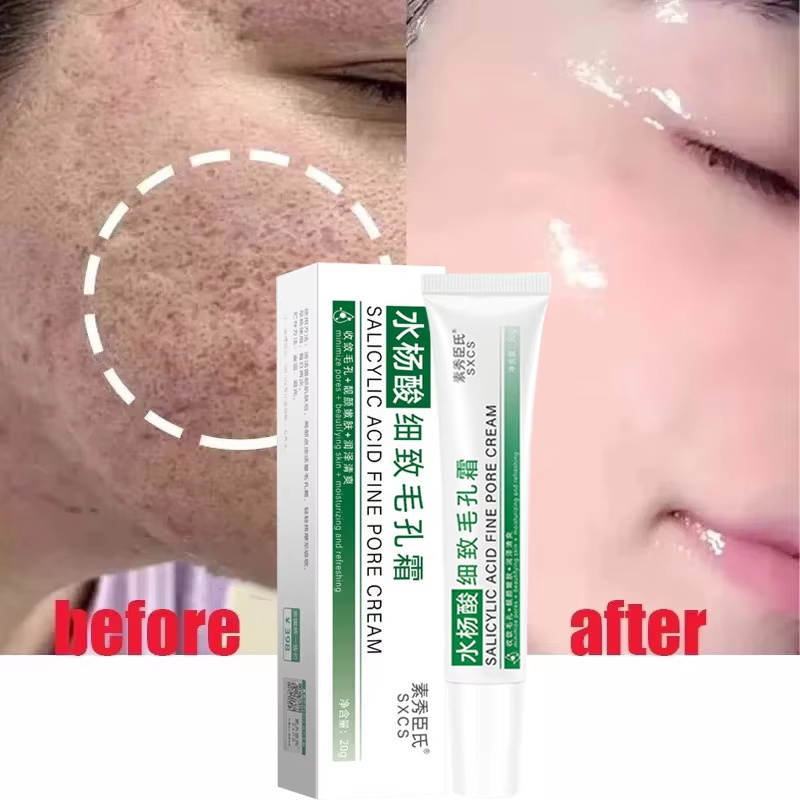 Salicylic Acid Pore Shrinking  - Skincare Salicylic Acid 评论和价格