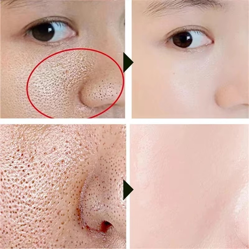 Salicylic Acid Pore Shrinking  - Skincare Salicylic Acid 评论和价格