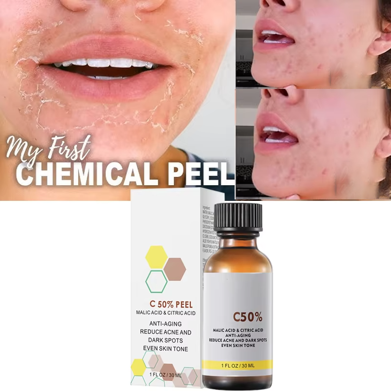 With Malic Acid And Citric Aci - Skincare Salicylic Acid 评论和价格