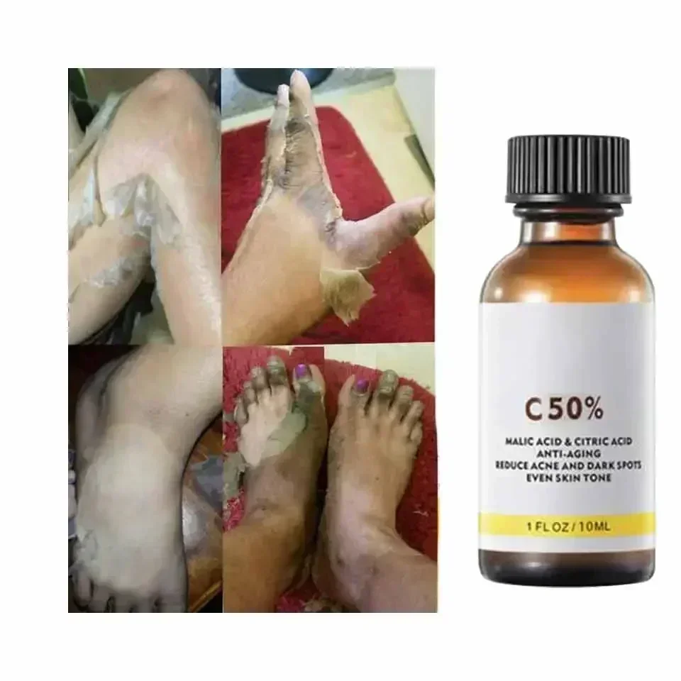 With Malic Acid And Citric Aci - Skincare Salicylic Acid 评论和价格